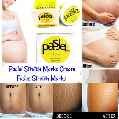 Stretch Marks Cream (Pasjel) 90g - Kyemen Baby Online
