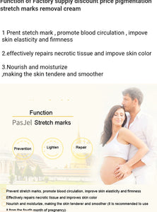 Stretch Marks Cream (Pasjel) 90g - Kyemen Baby Online